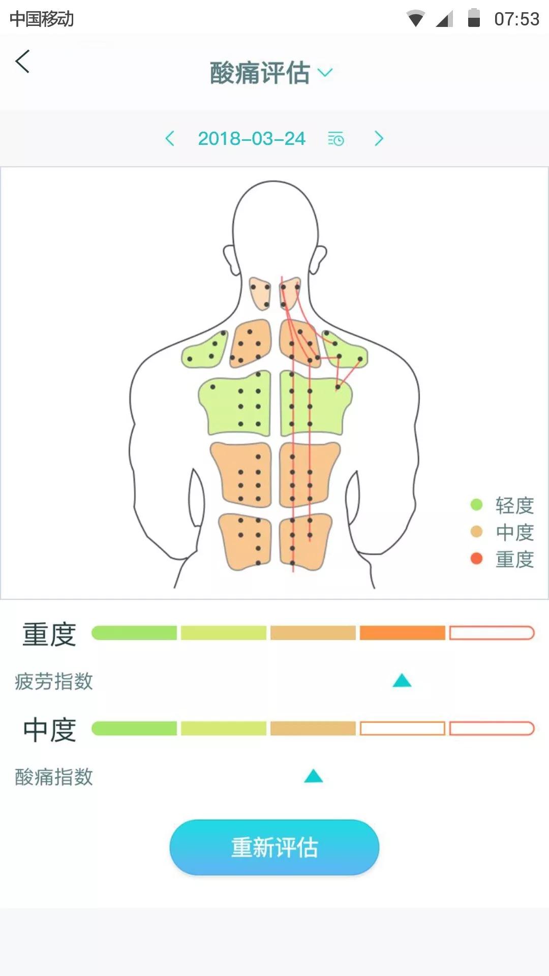 \