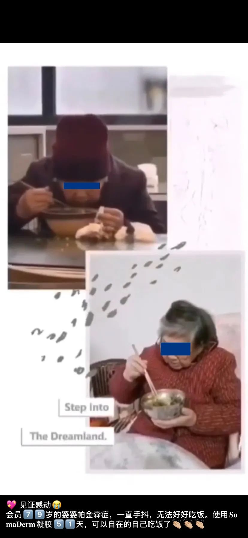 \